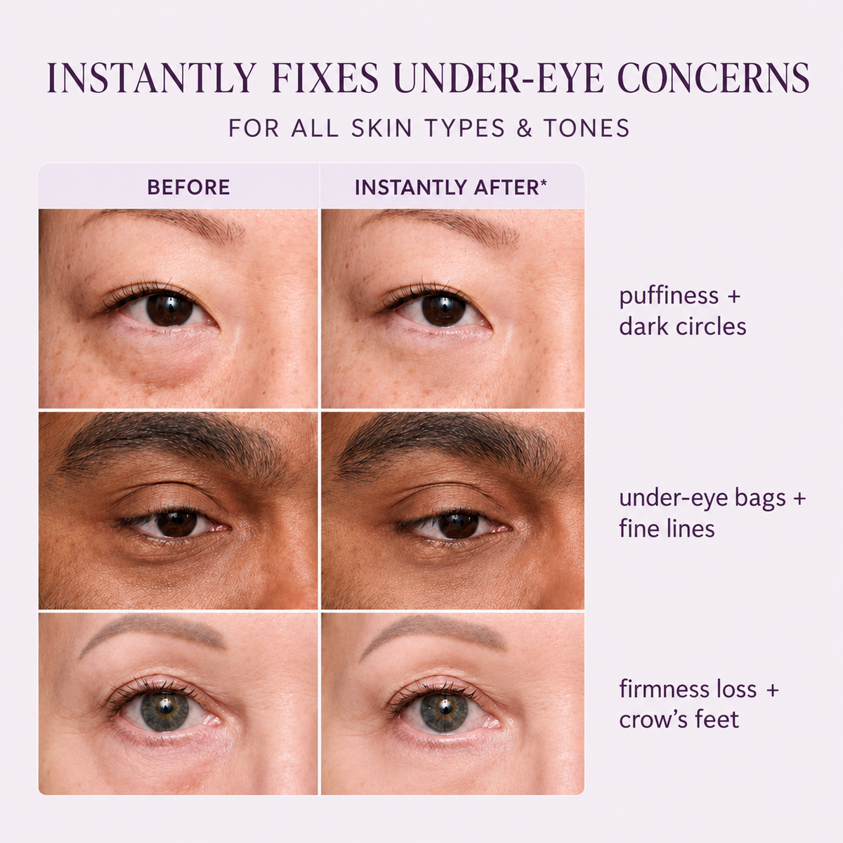 Mirevyn Instant Lift Face Tightener