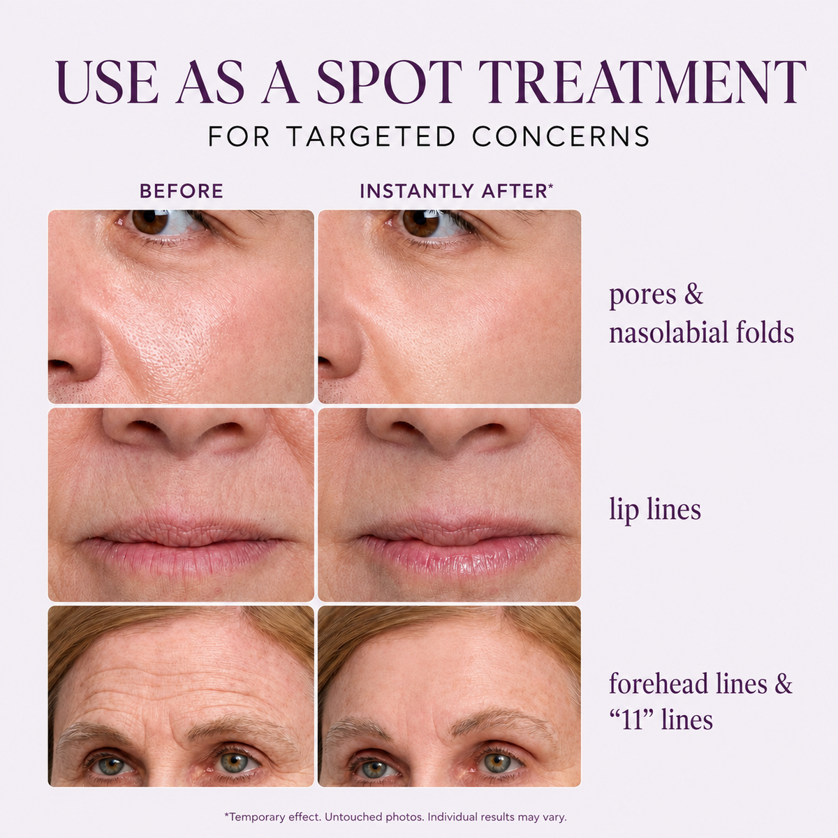Mirevyn Instant Lift Face Tightener
