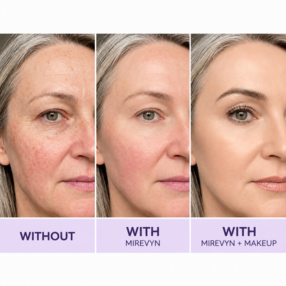 Mirevyn Instant Lift Face Tightener