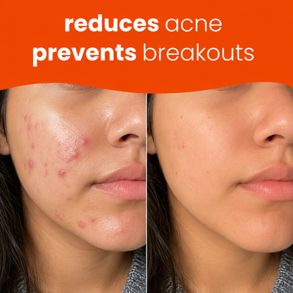 Prionne™ Turmeric + Kojic Acid Cleansing Pads