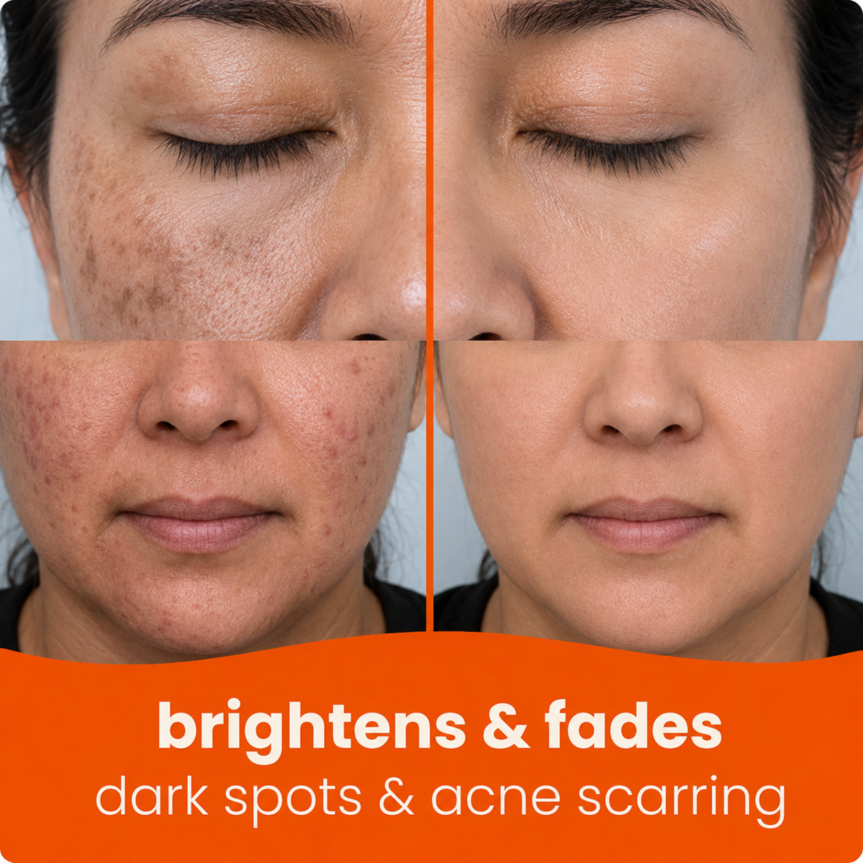 Prionne™ Turmeric + Kojic Acid Cleansing Pads