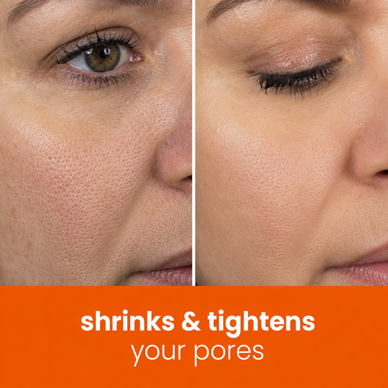 Prionne™ Turmeric + Kojic Acid Cleansing Pads
