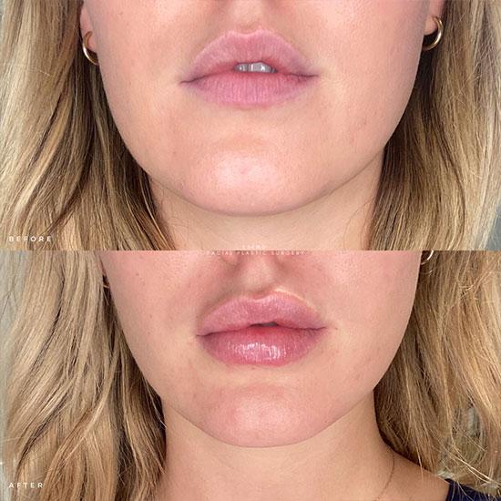 NESLEMY ✨ BUY MORE, GET MORE 👄Hydrating Collagen Mouth Tape