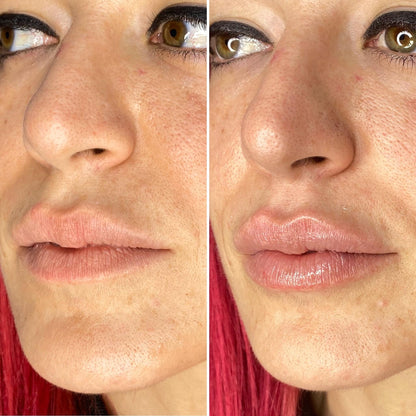 NESLEMY ✨ BUY MORE, GET MORE 👄Hydrating Collagen Mouth Tape